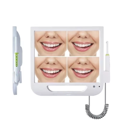 WLAN-System Zahn-USB-Intra-Oral-Kamera drahtlose Intra-Oral-Digitalkamera