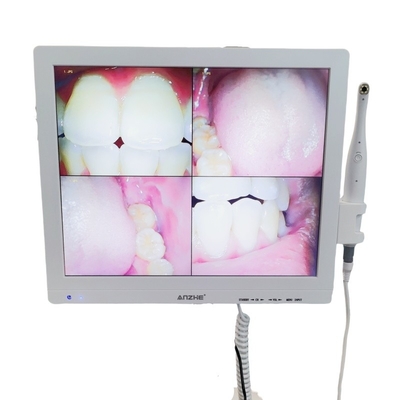 Wifi-All-in-One-Oralkamera mit Lautsprecher-LCD-Bildschirm Zahn-Oralkamera-Scanner