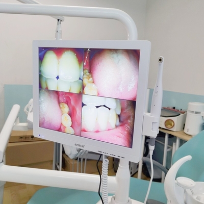 Wifi-All-in-One-Oralkamera mit Lautsprecher-LCD-Bildschirm Zahn-Oralkamera-Scanner