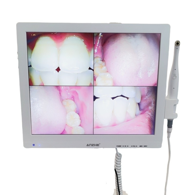 Wifi-All-in-One-Oralkamera mit Lautsprecher-LCD-Bildschirm Zahn-Oralkamera-Scanner