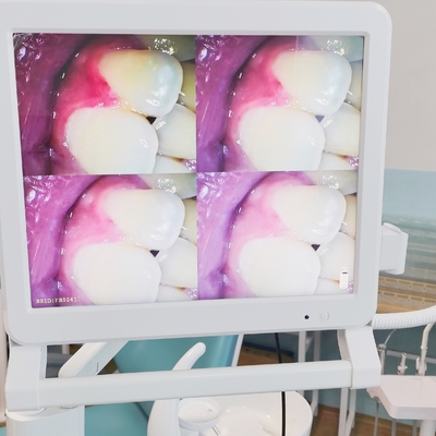Zahn-Endoskop mit 17-Zoll-Monitor Wifi Handheld Tragbare Zahnkamera Intraorale Endoskop Intraorale Kamera